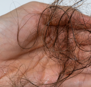 hair growth after illustration